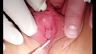 Teen britney gyno cunt speculum exam